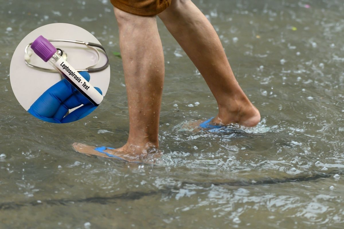 Leptospirosis